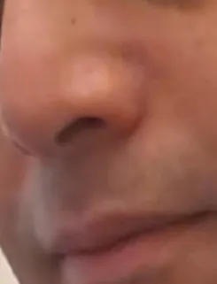 דומיננטי מחבק